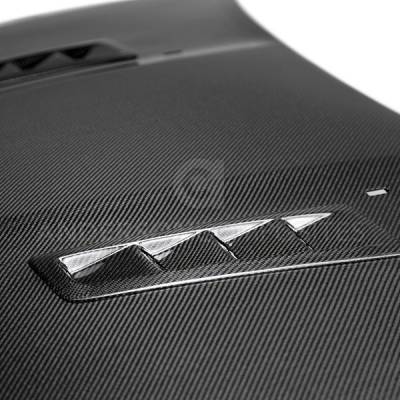 Anderson Carbon - Ford Focus SE/SS Type-RS Anderson Composites Fiber Body Kit- Hood AC-HD16FDFO-RS - Image 3